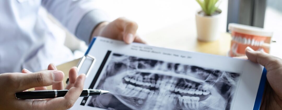 Frequently Asked Questions on Orthodontic Treatments