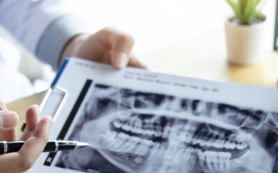 Frequently Asked Questions on Orthodontic Treatments